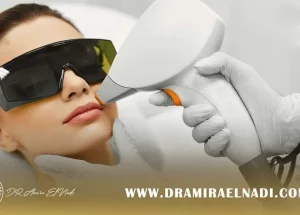 إزالة-الشعر-بالليزر