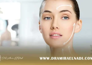 خيوط-جراحية-تجميلية-لرفع-الوجة